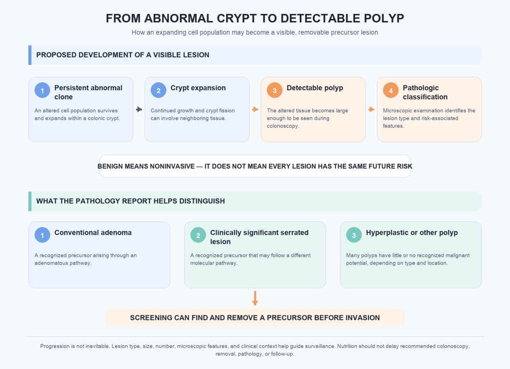 Diagram showing a proposed progression from a persistent abnormal cell clone through crypt expansion to a detectable polyp and pathological classification. Pathology distinguishes conventional adenomas, clinically significant serrated lesions, and hyperplastic or other polyps. Benign means noninvasive, progression is not inevitable, and screening can find and remove precursor lesions before invasion.